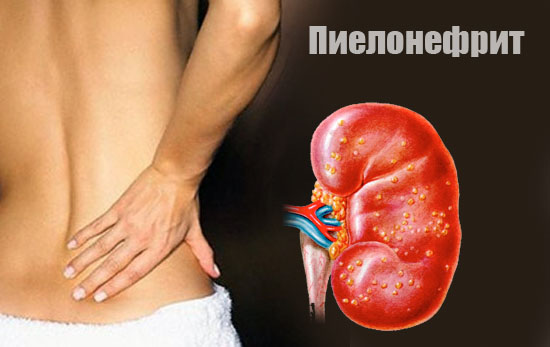 Осмолярность мочи: что это такое, методы определения