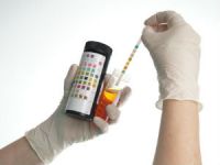 Желчные пигменты в моче: что это значит, норма их содержания Желчные пигменты в моче: что это значит, норма их содержания