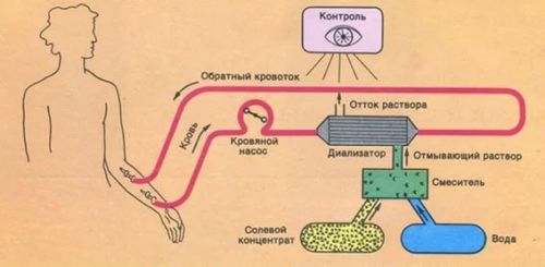 Глюкозурия (почечная и при сахарном диабете), причины и лечение