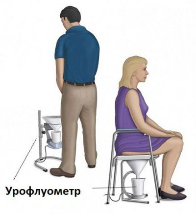 Урофлоуметрия: как проводится обследование, показатели нормы