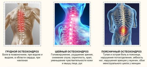 Как болят почки у женщин: симптомы и признаки, от чего возникает боль