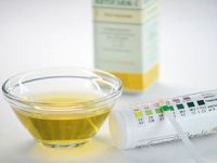 Тест-полоски для мочи, диагностический анализ определения pH