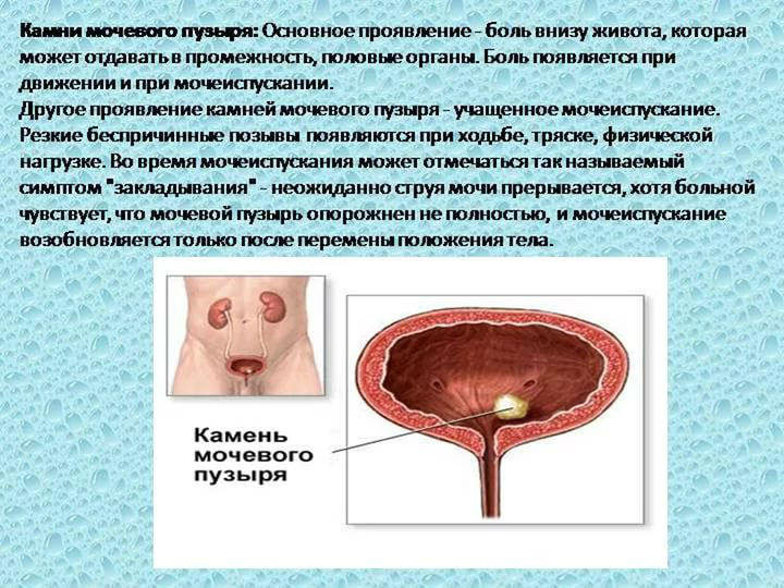 Мочевой пузырь не опорожняется полностью у женщин и мужчин: причины, лечение