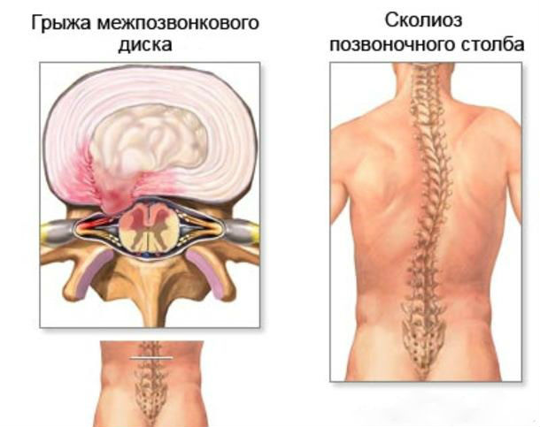 Болят почки: симптомы и лечение, чем лечить ноющие боли