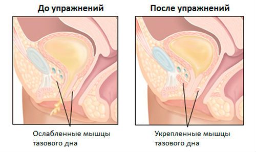 Частое мочеиспускание после родов и другие проблемы с ним