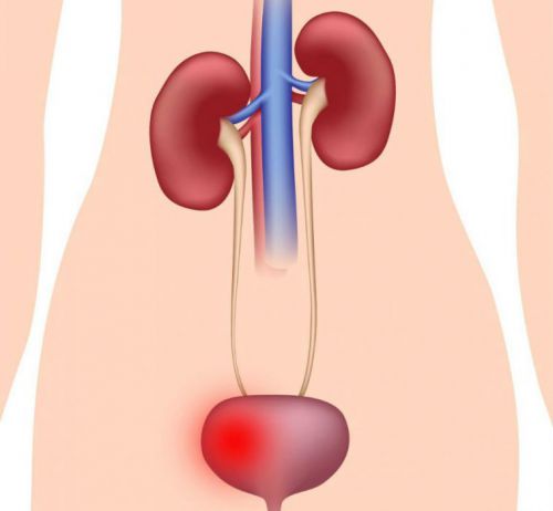 Неприятный запах мочи у женщин: причины почему она плохо пахнет Неприятный запах мочи у женщин: причины почему она плохо пахнет