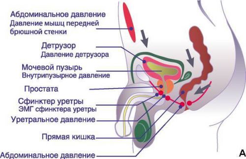 Императивные позывы к мочеиспусканию и недержание мочи