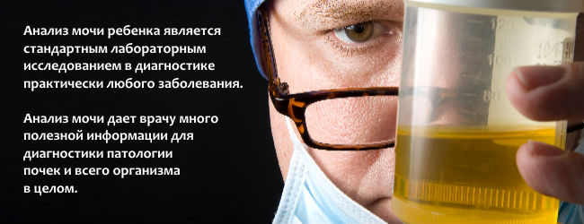 Моча темного цвета (темно-желтого): причины потемнения, что это значит