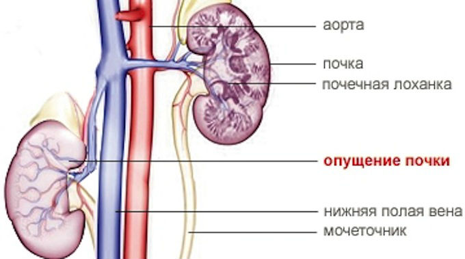 Болит почка с левой стороны: симптомы и лечение боли, что делать