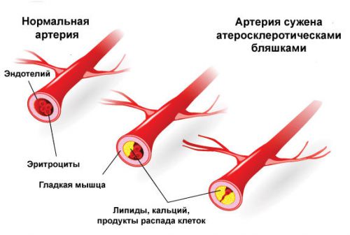 Болит почка с левой стороны: симптомы и лечение боли, что делать