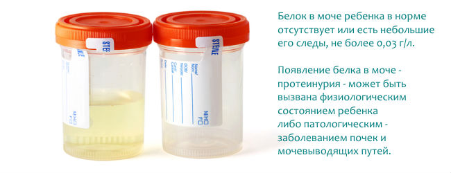 Микроальбумин в моче (анализ на МАУ): что это, как сдавать и собирать