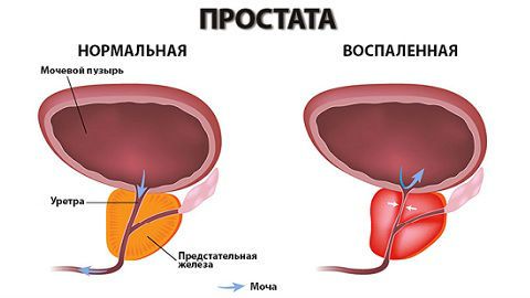 Боль после мочеиспускания у женщин и мужчин внизу живота: причины и лечение