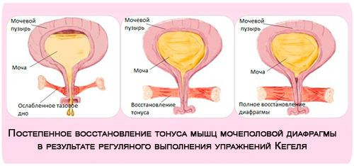 Подтекание мочи после родов: почему у женщин не держится моча