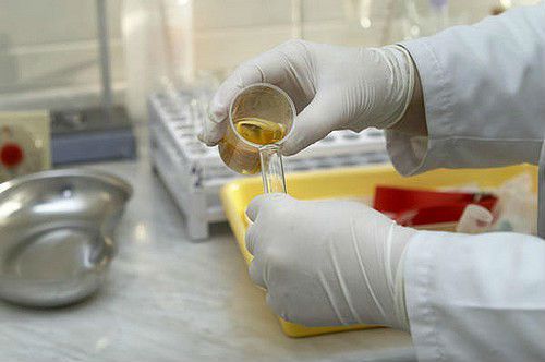 Расшифровка анализа мочи: нормальные показатели у взрослых, таблица нормы