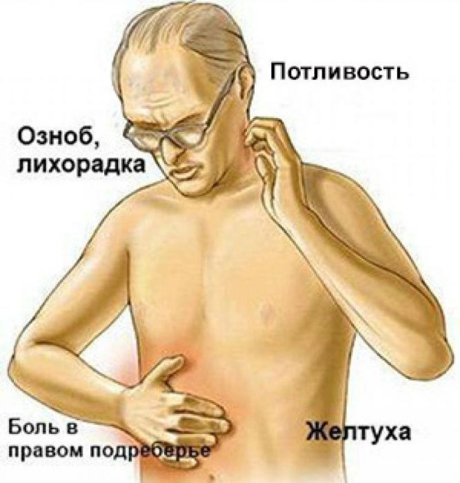 Билирубин в моче: что это значит, норма у ребенка, при беременности, причины