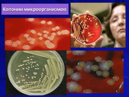 Микробиологическое исследование мочи, зачем проводят анализ
