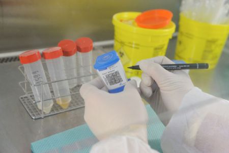 Анализ мочи на туберкулез вместо манту, суть метода