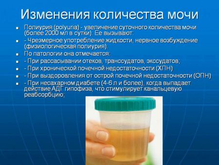 Норма мочи в сутки у взрослого, количество суточного объема у человека
