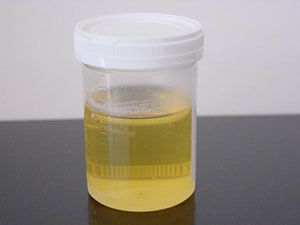 Количество мочи для анализа (минимальное), какой объем необходим