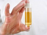 Enterococcus Faecalis в моче, норма энтерококка у женщин и ребенка