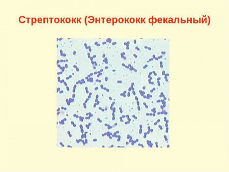 Enterococcus Faecalis в моче, норма энтерококка у женщин и ребенка