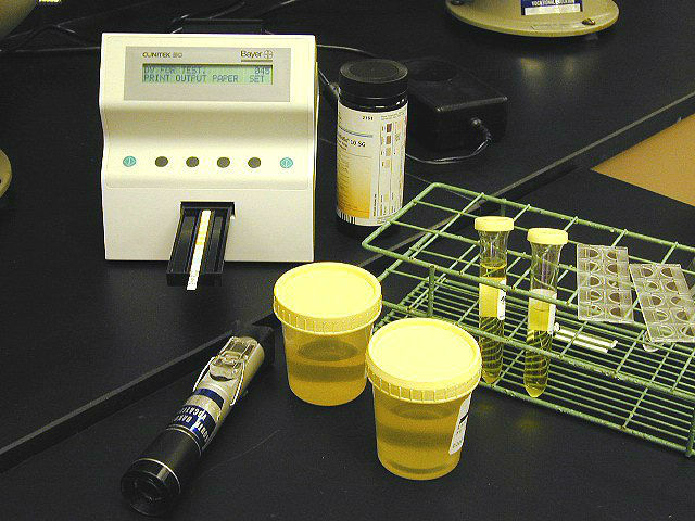 Общий анализ мочи: расшифровка результатов, таблица нормы у взрослых Общий анализ мочи: расшифровка результатов, таблица нормы у взрослых