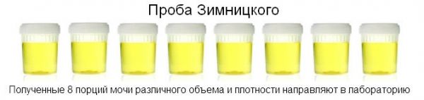 Расшифровка общего анализа мочи у детей: таблица нормы у ребенка