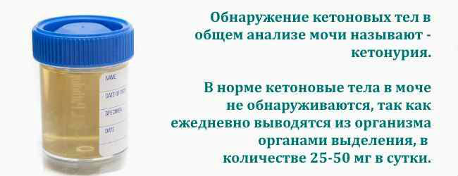 Ацетон в моче у взрослых: причины, что это значит в анализе, лечение