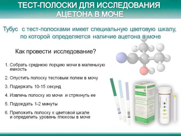 Ацетон в моче у взрослых: причины, что это значит в анализе, лечение