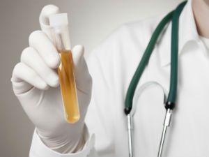 Повышены лейкоциты и эритроциты в моче: норма, причины повышения