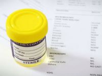 Анализ мочи по Зимницкому: как собирать, алгоритм сбора, что показывает Анализ мочи по Зимницкому: как собирать, алгоритм сбора, что показывает