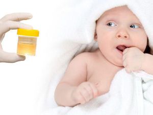 Повышены лейкоциты в моче у грудничка: причины, норма белка у новорожденных