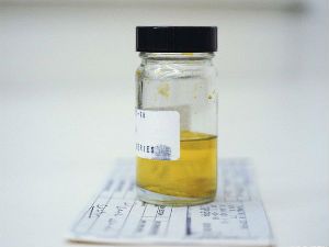 Слизь в моче у женщин: причины при беременности, что это означает
