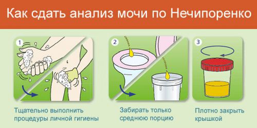 Повышенные лейкоциты в моче: что это значит, почему их много