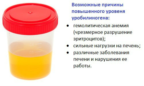 Уробилин в моче, норма его показателей и что это значит