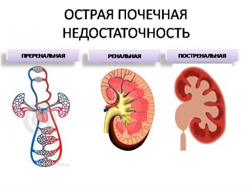 Главные функции почек в организме человека, их взаимосвязь со строением органа