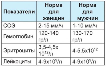 СОЭ в моче: что это значит, норма у женщин и детей