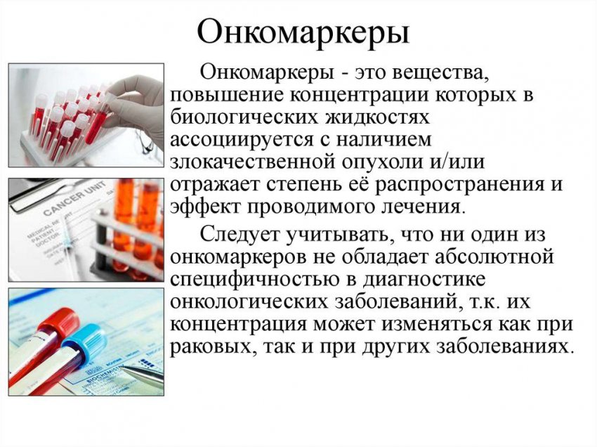 Онкомаркер Cyfra 21-1: что означает, показатель нормы у мужчин и женщин, расшифровка результатов