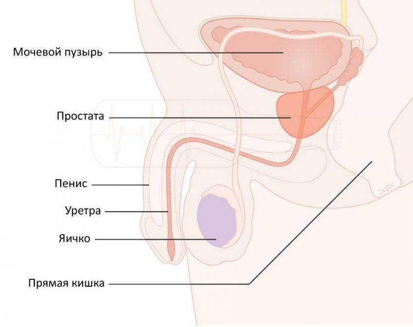 Аденокарцинома предстательной железы: виды, симптоматика и диагностика болезни, методы и схемы лечения