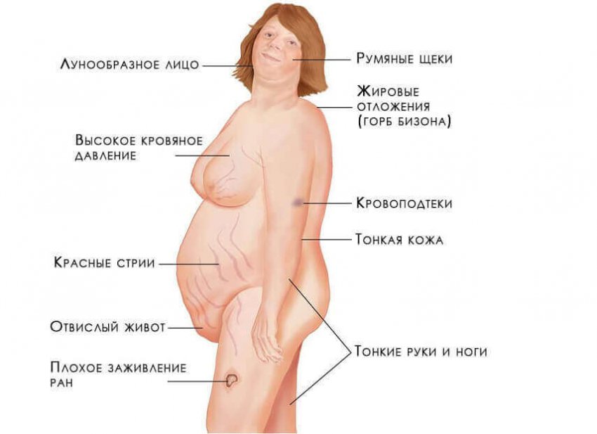 Опухоли надпочечников: что это такое и лечение рака надпочечника, прогноз онкологов на выживание, что говорят врачи о восстановлении