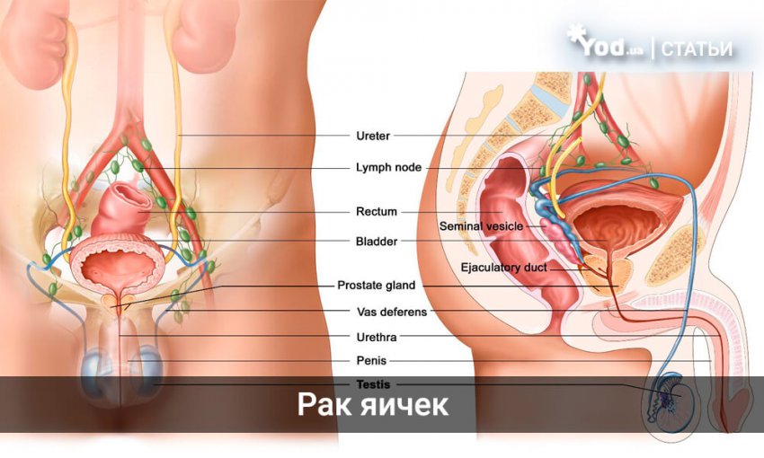 Рак яичка у мужчин: основная информация о заболевании, виды и предрасполагающие к развитию факторы, методы лечения болезни