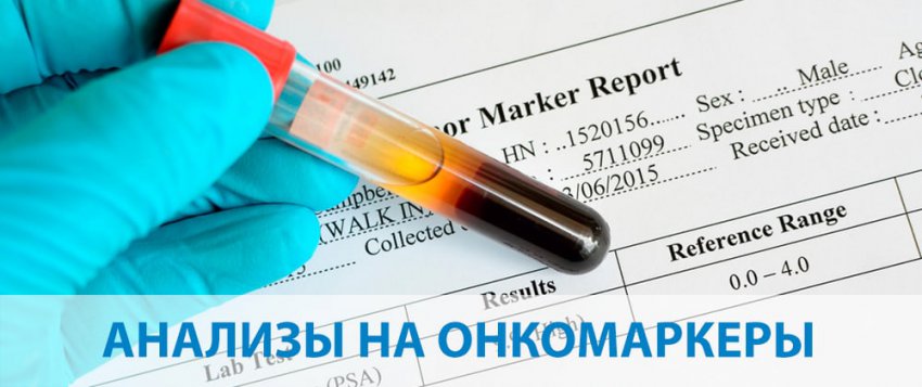 Самые важные онкомаркеры на онкологию легкого: список анализов и расшифровка результатов, подготовка к анализам