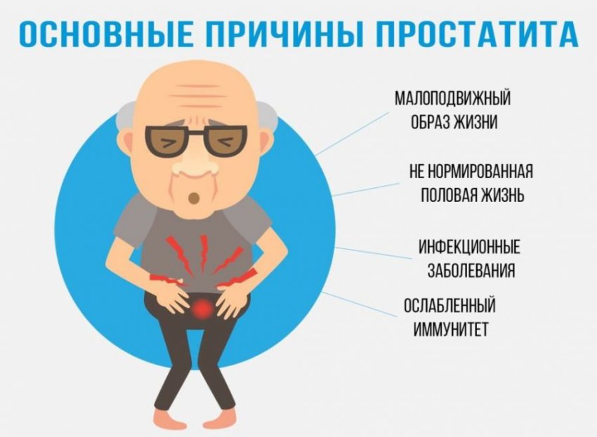 Конгестивный простатит (хронический): причины, симптомы, лечение