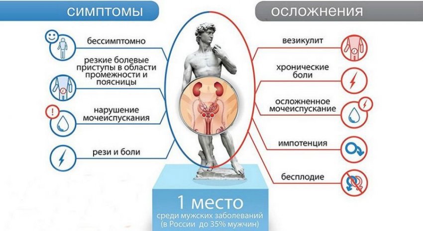 Острый простатит у мужчин: симптомы, лечение лекарствами и препаратами, последствия