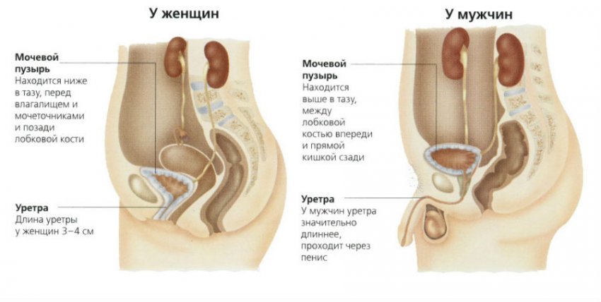 Лейкоплакия мочевого пузыря: симптомы и лечение, отзывы после операции