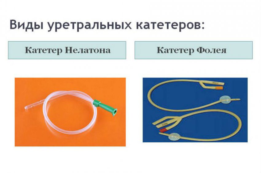 Катетер для мочи: классификация, техника выведения урины
