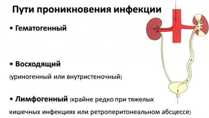 Бактерии в моче у женщин, причины их повышения в анализе