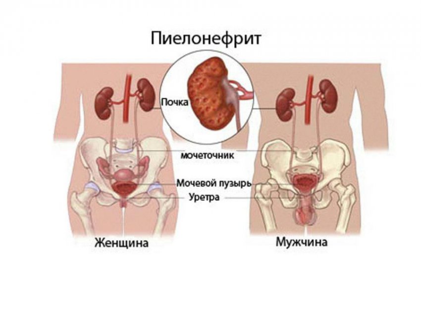 Диагностика болезней почек, основные симптомы заболеваний
