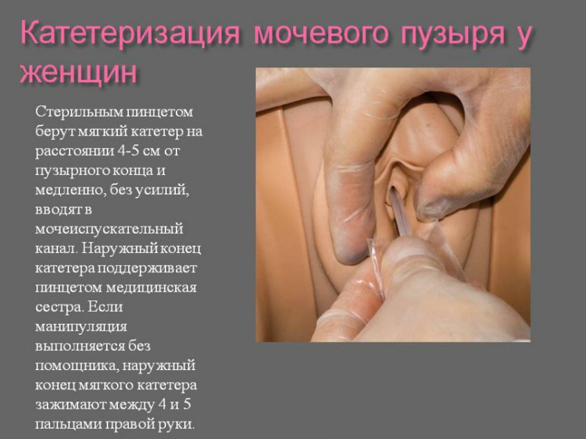 Мочевой пузырь не опорожняется полностью у женщин и мужчин: причины, лечение