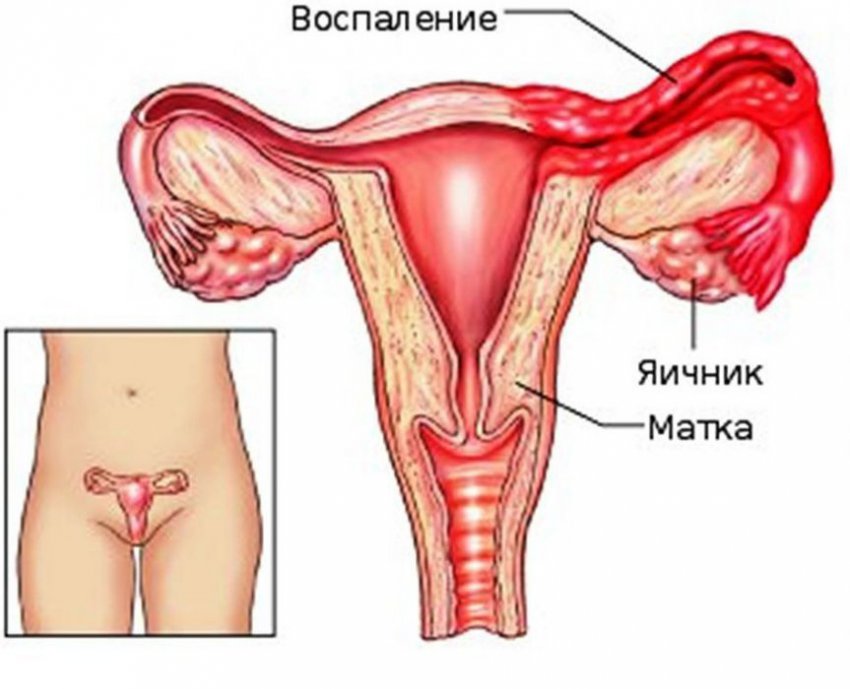 Боль при мочеиспускании у женщин: причины болезненных ощущений и жжения